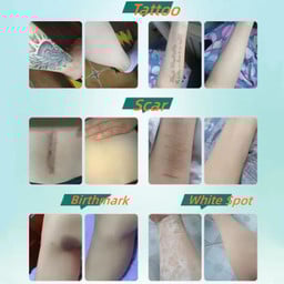 Plasterki zakrywające tatuaże i blizny™