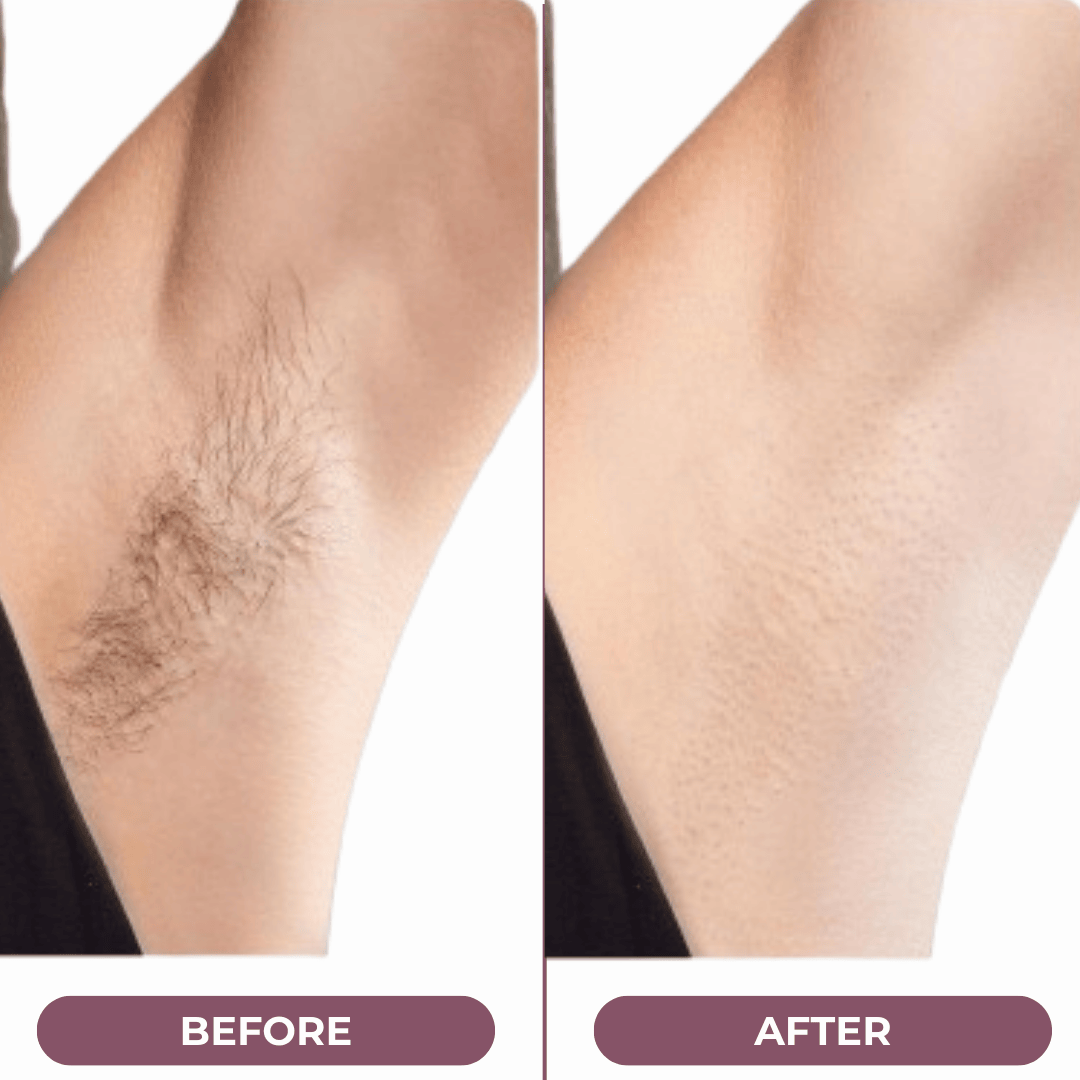 Dwa w jednym elektryczny trymer do włosów 