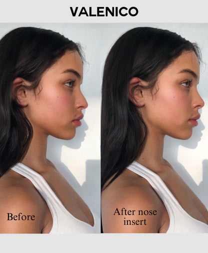 6 szt./zestaw wkładek do kształtowania nosa