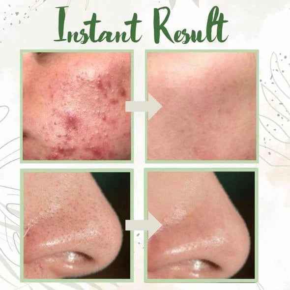 Maska głęboko oczyszczająca z zieloną herbatą