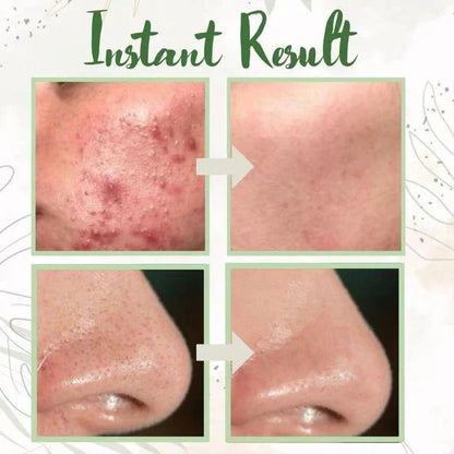 Maska głęboko oczyszczająca z zieloną herbatą