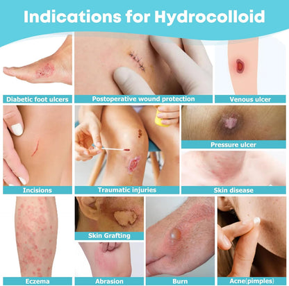 Rolka hydrokoloidowa do pielęgnacji ran