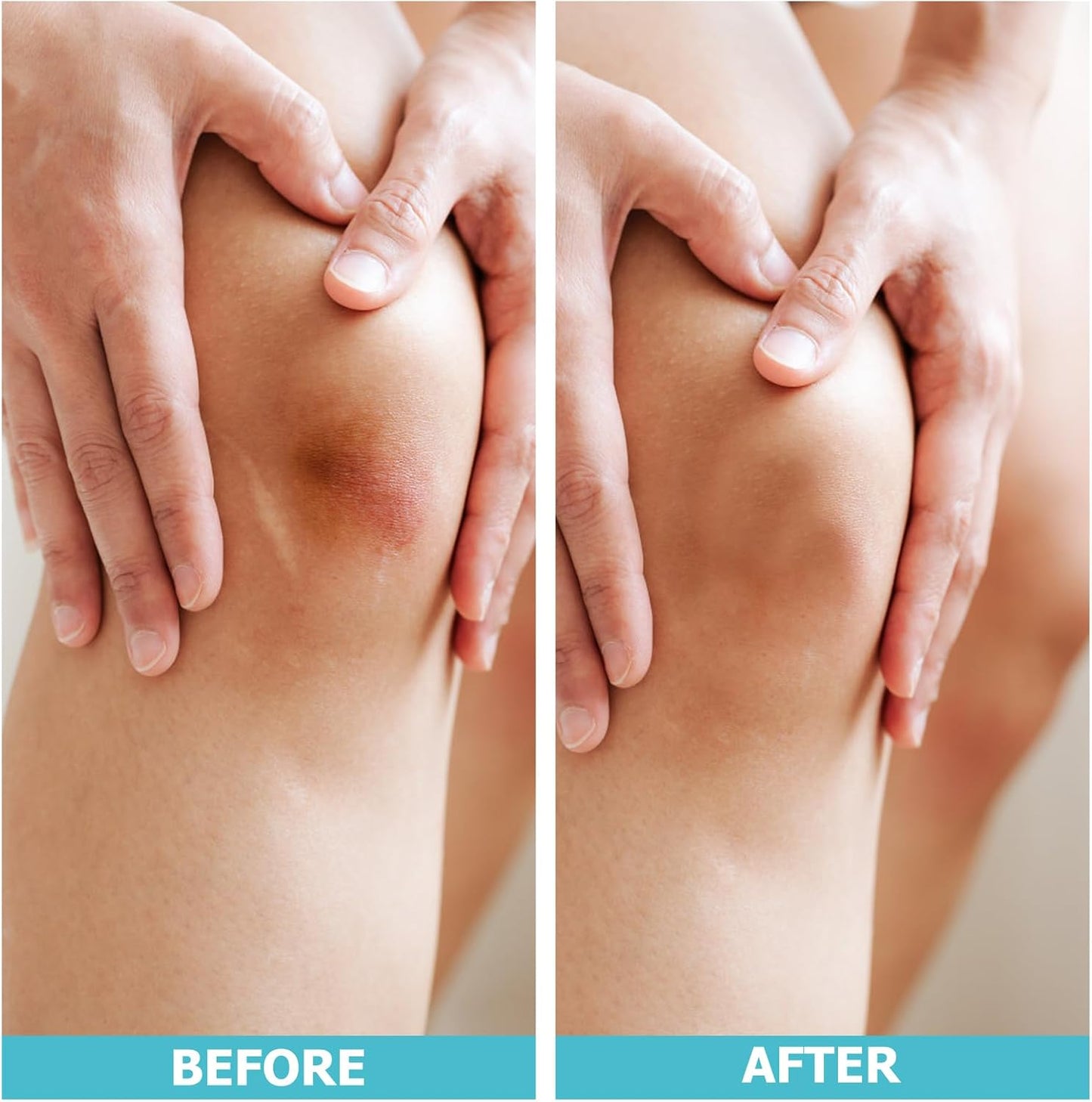 Rolka hydrokoloidowa do pielęgnacji ran