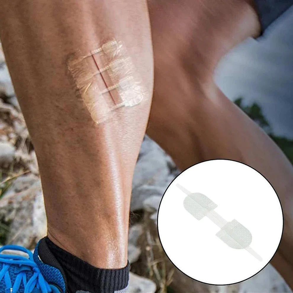 Zestaw do zamykania ran Everlit – 2 szt., paski bez szwów