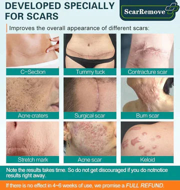ScarRemove™ Zaawansowany spray na blizny