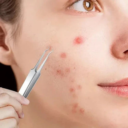 Profesjonalna pęseta do usuwania zaskórników (3 szt. + opakowanie)