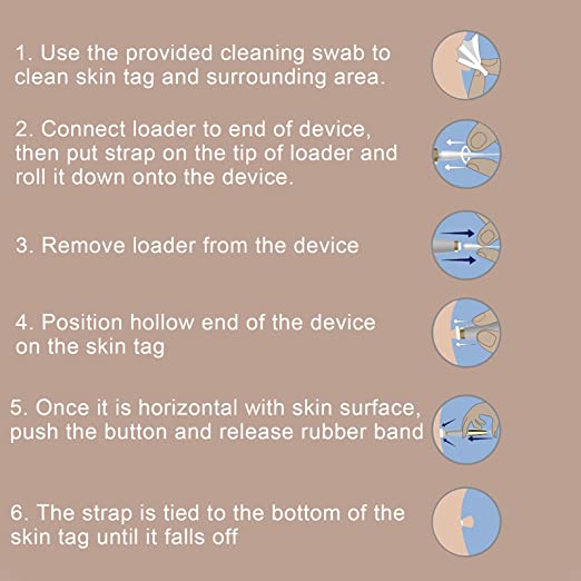 ZESTAW DO BEZBOLESNEGO AUTOMATYCZNEGO USUWANIA NADRUKÓW SKÓRNYCH™