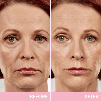 V-Face Lifting Niewidoczna Taśma Klejąca