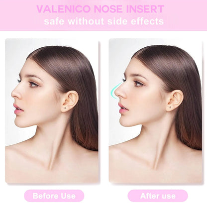 6 szt./zestaw wkładek do kształtowania nosa