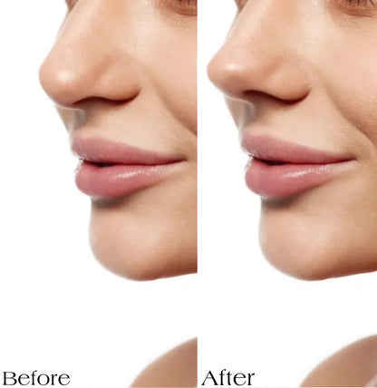 6 szt./zestaw wkładek do kształtowania nosa