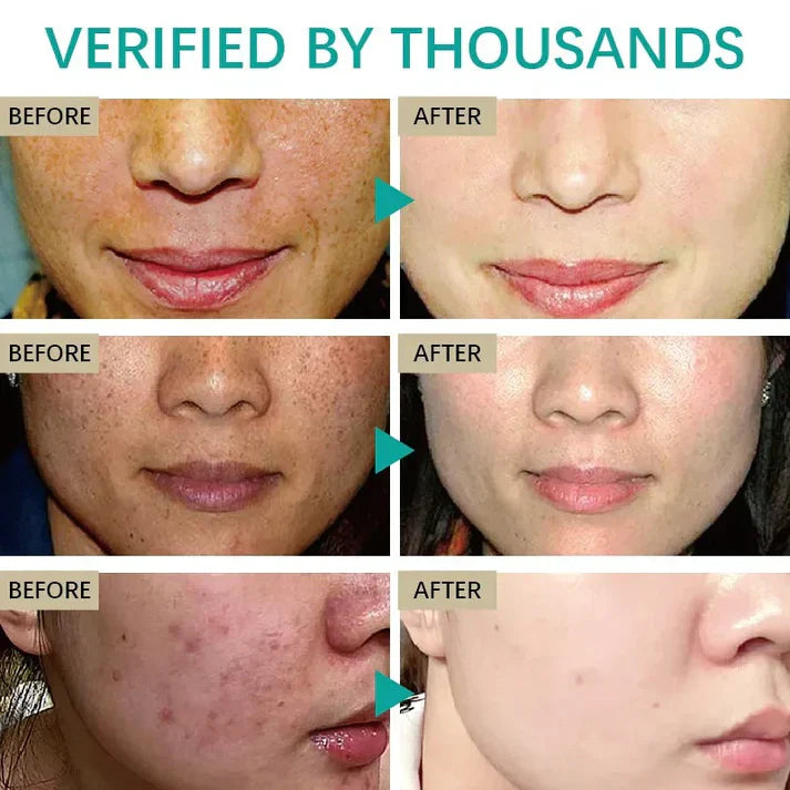 Krem rozjaśniający ciemne plamy