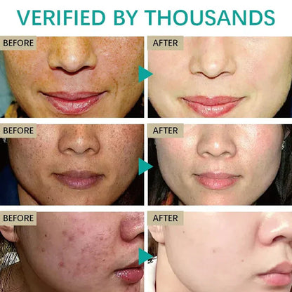 Krem rozjaśniający ciemne plamy